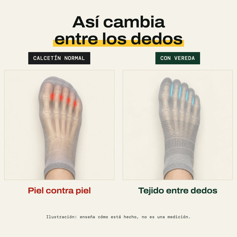 Comparación ilustrada: con un calcetín normal los dedos se tocan; con VEREDA hay tejido entre ellos